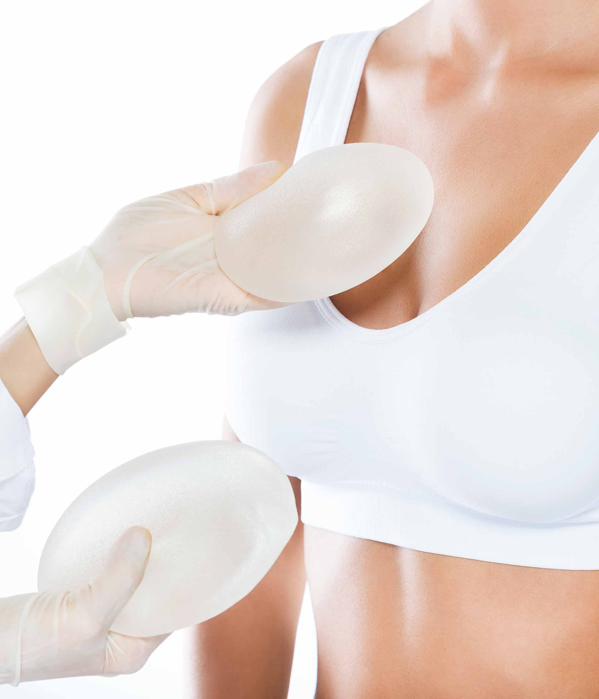 Mamoplastia de aumento