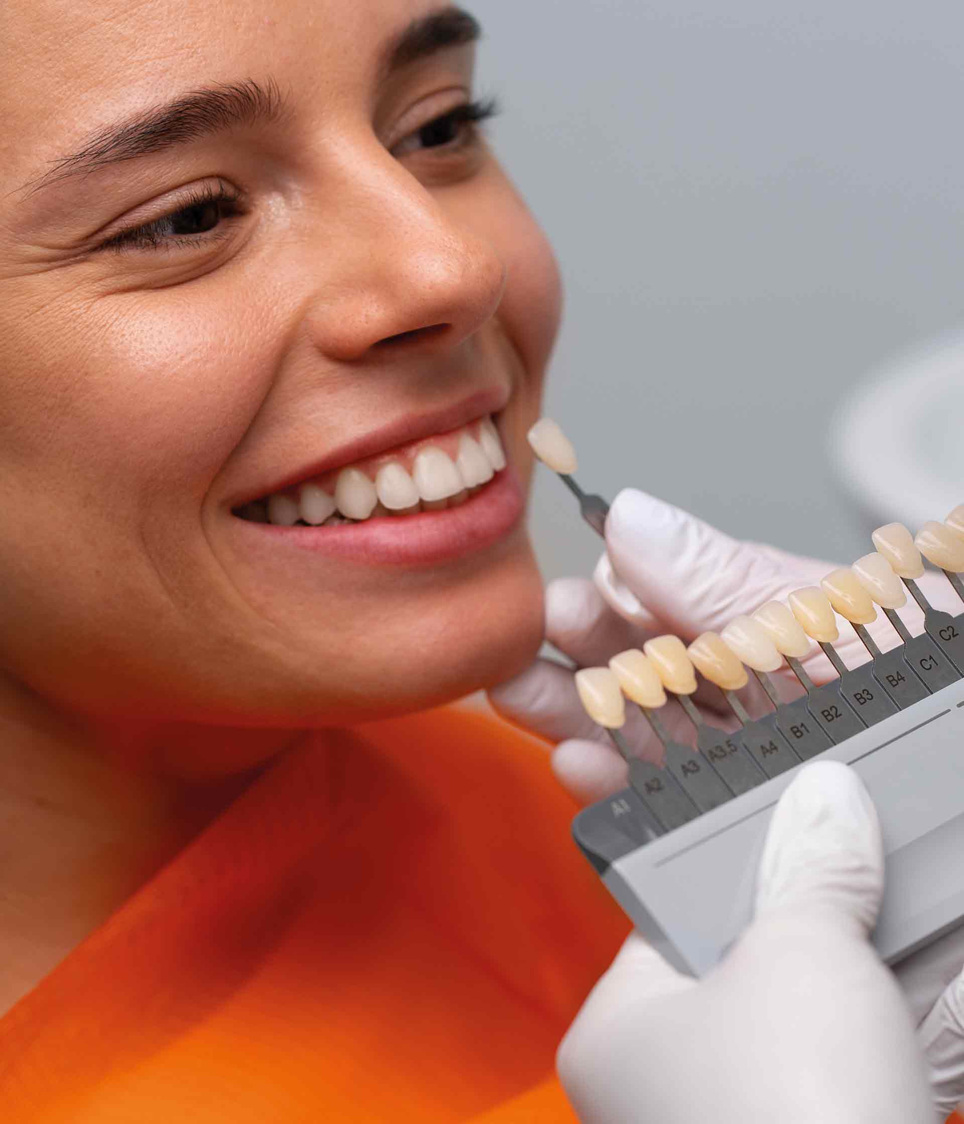 Blanqueamiento dental