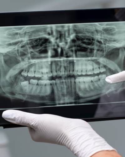 maxilofacial