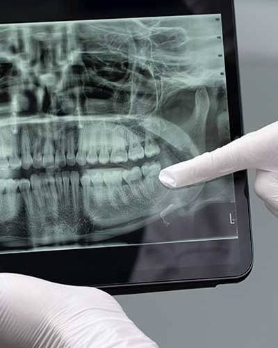 procedimientos-cdentales1-400x600px